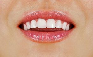 6 Tips to Get Healthy White Teeth Dentist Yeronga