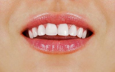 Yeronga Dentist Tips: 6 Effective Ways to Get Healthy, White Teeth