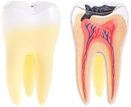 Dental Abscess Emergency Yeronga
