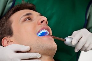 Dental Sealants Yeronga