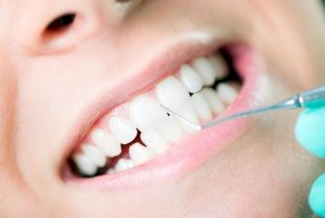 Gum Disease Treatment Yeronga