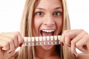 dental veneers yeronga