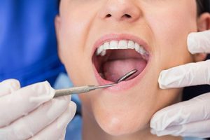 Preventive Dentistry Dentist Yeronga