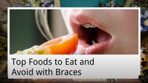 top foods to eat and avoid with braces from ria family dental