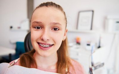 How to Keep Teeth Clean with Braces