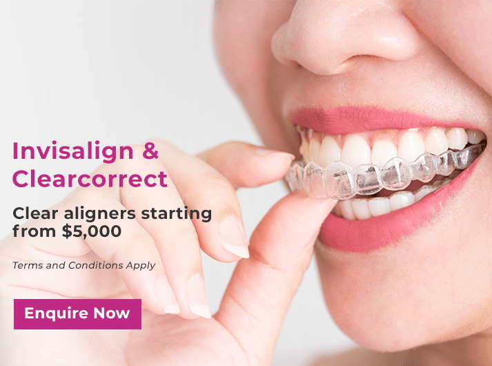 invisalign and clearcorrect promo banner yeronga