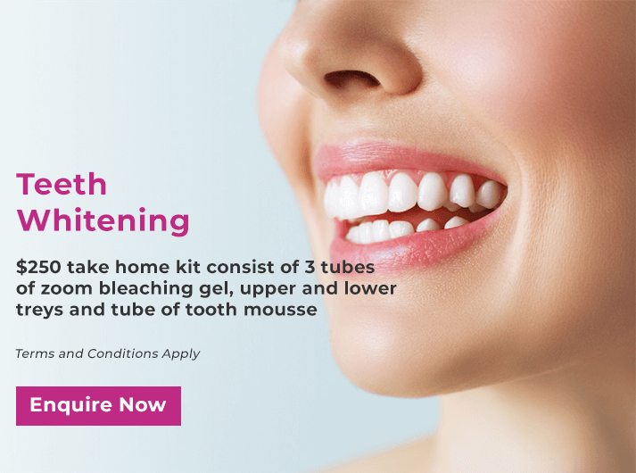 teeth whitening promo banner yeronga